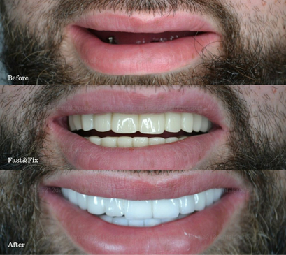 Slider image (10) Dis 212 - Dental Aesthetics Facility